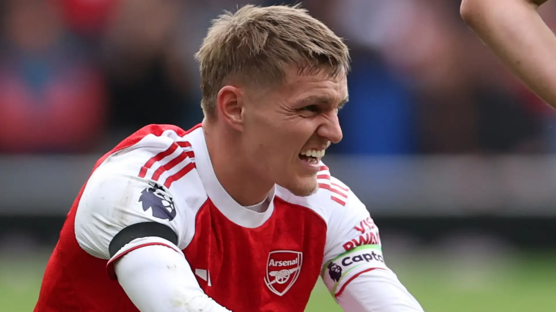 Martin Ødegaard Ditarik dari Skuad Timnas Norwegia Akibat Cedera