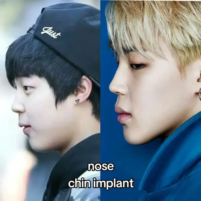 Dituduh Operasi Plastik Hidung dan Dagu, Jimin BTS Jadi Perdebatan
